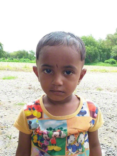 World Vision India